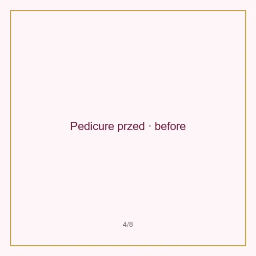 Pedicure przed
